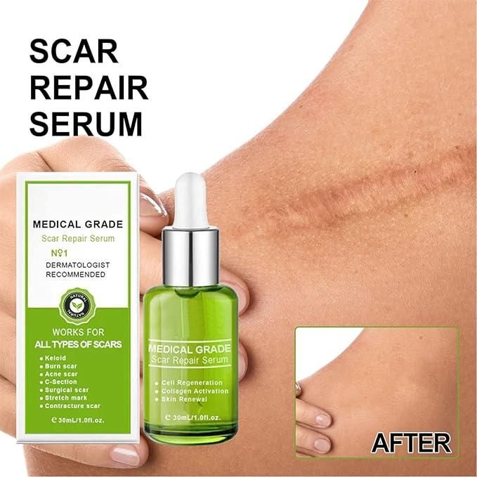 Scar Repair Essence Advanced Scar Gel 30 ML Pack of 1