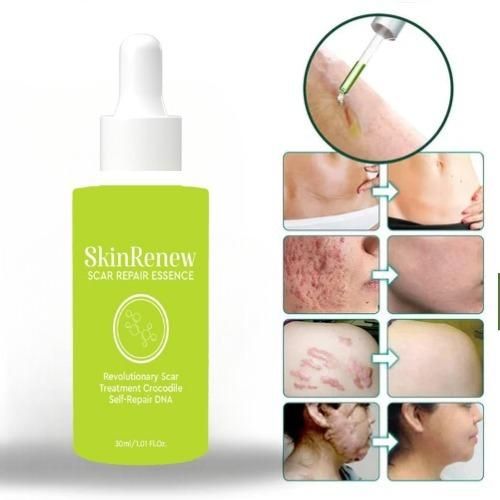 Skinrenew Scar Repair Essence