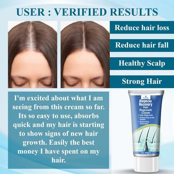 CASSIDY Alopecia Recovery Hair Regrowth Cream 50gm